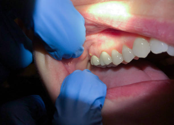 Best Emergency Dental Care for Broken or Chipped Teeth in Walden, TN